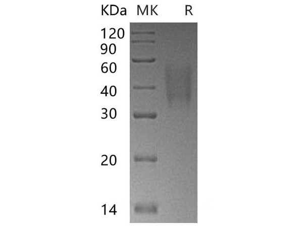 Human TRAIL R3/TNFRSF10C Recombinant Protein (RPES1041)