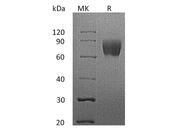 Human LFA-3/CD58 Recombinant Protein (RPES1046)