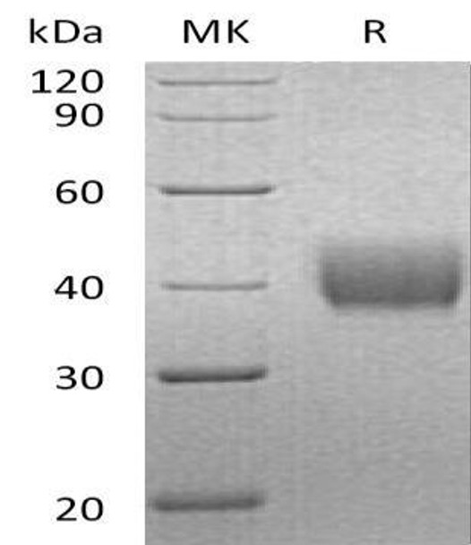 Human Mesothelin/MSLN Recombinant Protein (RPES1049)