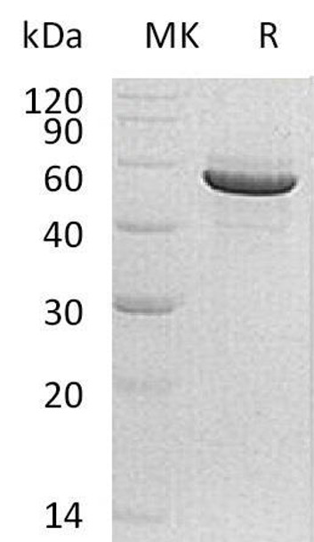 Human PACSIN1/Syndapin Recombinant Protein (RPES1058)