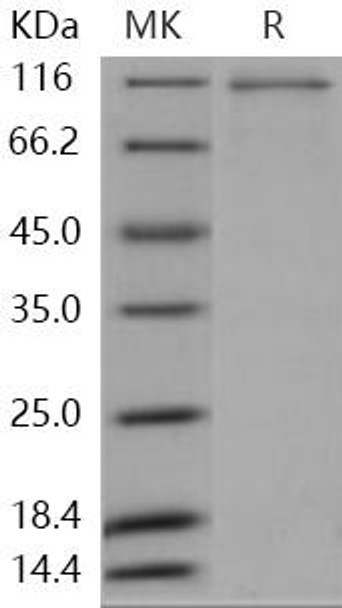 Human MAP4K2/GC Kinase Recombinant Protein (RPES1066)