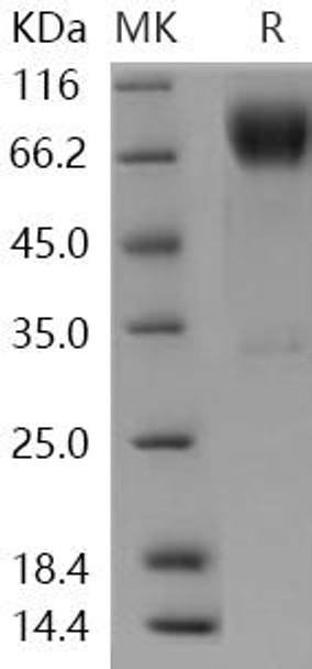 Human ICOS Ligand/ICOSL Recombinant Protein (RPES1068)