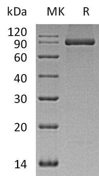 Human PACSIN2/Syndapin-2 Recombinant Protein (RPES1076)
