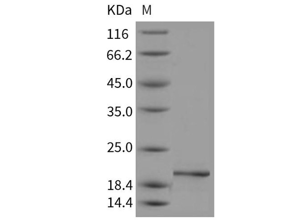 Mouse Pleiotrophin Recombinant Protein  (RPES1078)