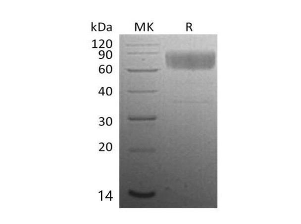 Mouse CD47 Recombinant Protein (RPES1079)