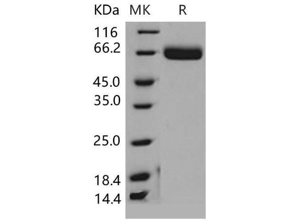 Mouse EphA4/HEK8 Recombinant Protein (RPES1091)