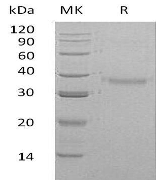 Human CRHBP Recombinant Protein (RPES1093)