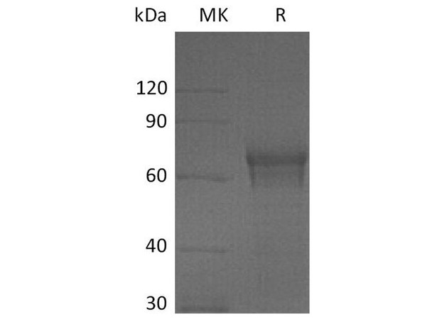 Human IL15RA/IL5RA Recombinant Protein (RPES1094)