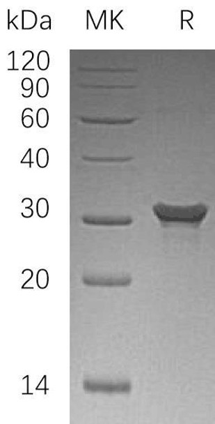 Human PAFAH1B2/PAFAHB Recombinant Protein (RPES1095)