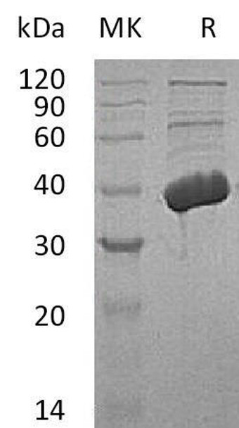 Human MECR Recombinant Protein (RPES1096)