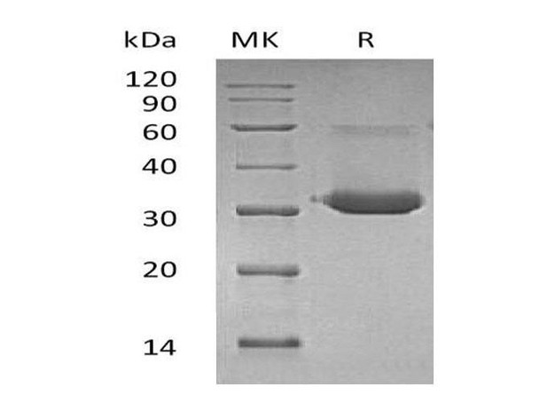 Mouse IgG1 Fc/IGHG1 Recombinant Protein (RPES1098)