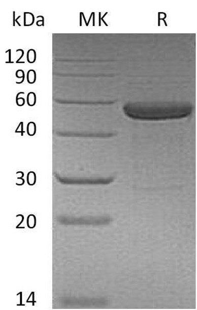 Human IL15RA&IL15 Fusion Recombinant Protein (RPES1113)