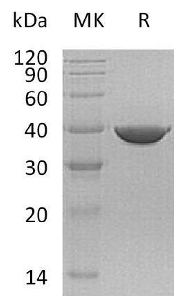 Human Transaldolase/TALDO1 Recombinant Protein (RPES1115)