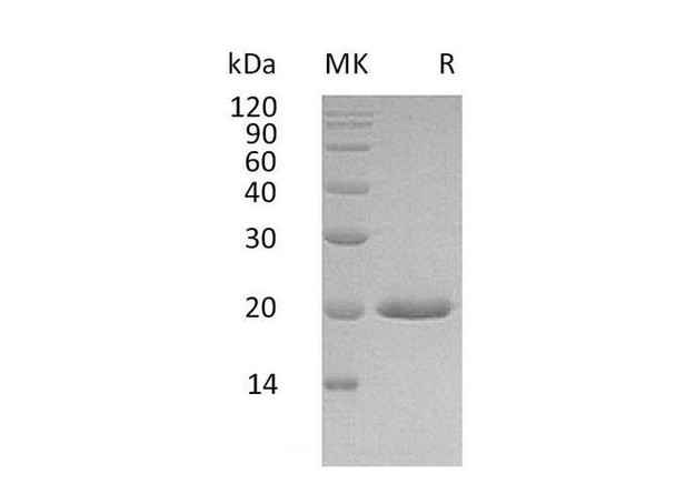 Human IFNA4 Recombinant Protein (RPES1120)