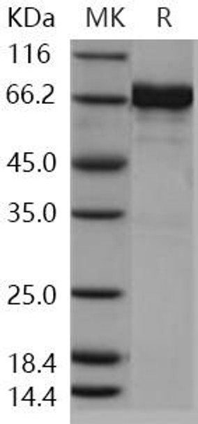 Human EphA7/EHK3 Recombinant Protein (RPES1123)