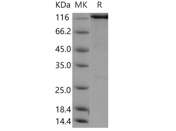 Human WWP2 Recombinant Protein (RPES1124)