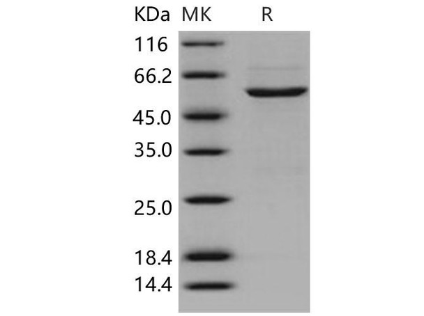 Human CDK4 Recombinant Protein (RPES1126)