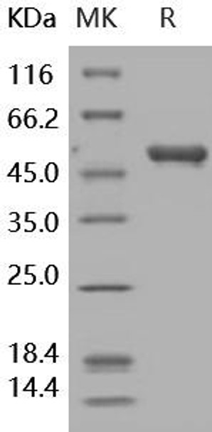 Human Cystatin 7/CST7 Recombinant Protein (RPES1127)