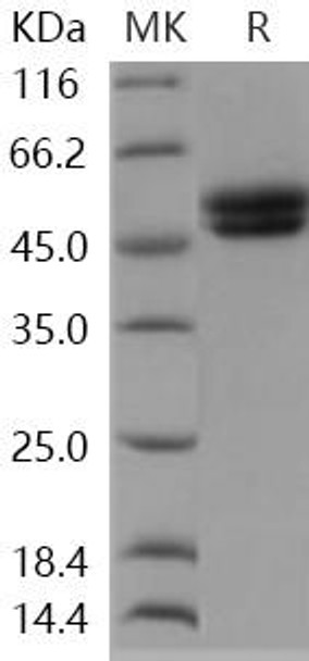 Human AGER/RAGE Recombinant Protein (RPES1130)
