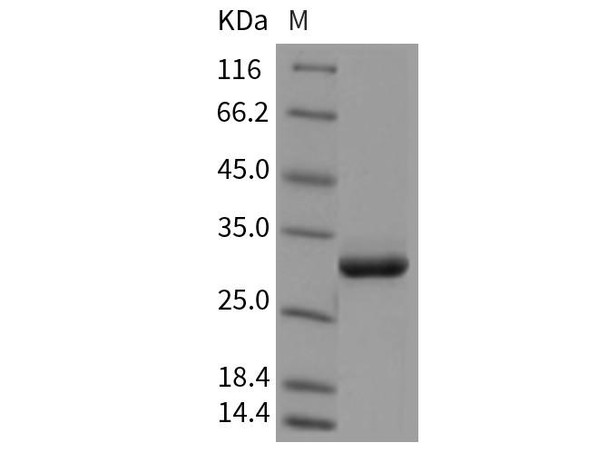 Rat APCS/SAP Recombinant Protein (RPES1148)