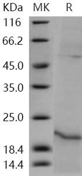 Human Relaxin/RLN1 Recombinant Protein (RPES1150)