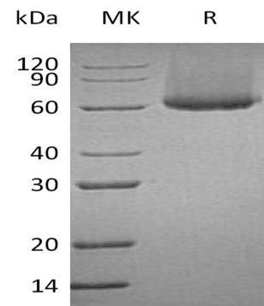 Human CRTAM /CD355 Recombinant Protein (RPES1152)