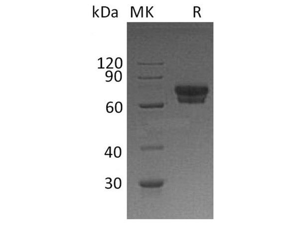 Human IL2Ra/CD25 Recombinant Protein (RPES1153)