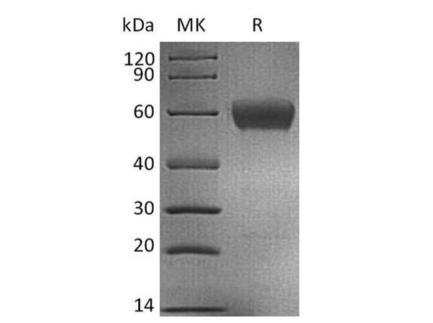 Human CD47/IAP Recombinant Protein (RPES1178)