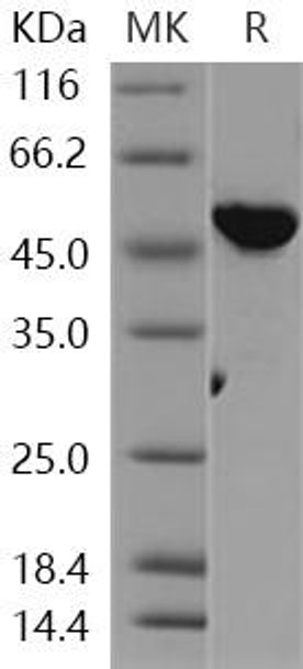 Human VRK1 Recombinant Protein (RPES1187)