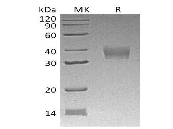 Mouse LILRB4/CD85k/ILT3 Recombinant Protein (RPES1197)