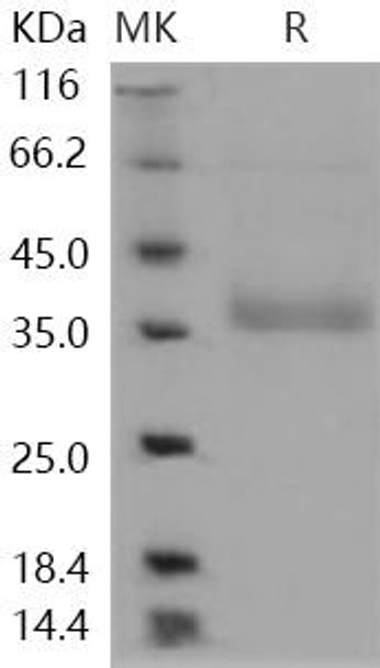 Human NCR2/NKp44/CD336 Recombinant Protein (RPES1200)