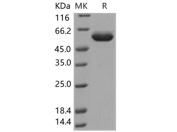 Human EPO Receptor/EPOR Recombinant Protein (RPES1218)