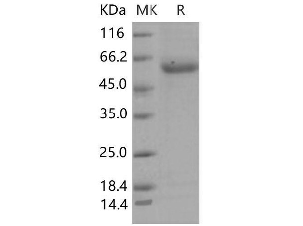 Mouse ENPP7/NPP-7 Recombinant Protein (RPES1221)