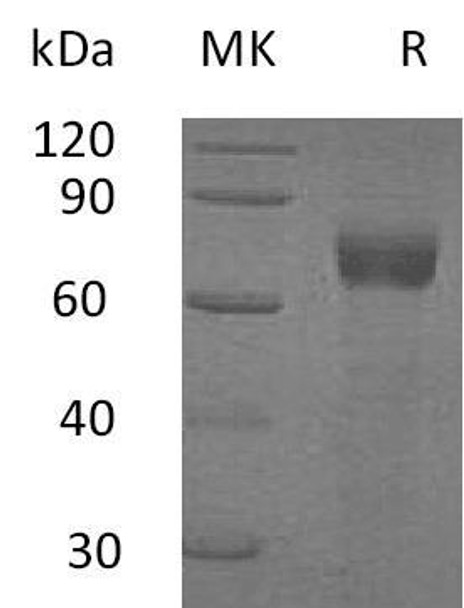 Human IL-20RA/IL-20R1 Recombinant Protein (RPES1240)