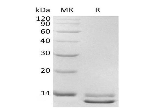 Human TGFB3 Recombinant Protein  (RPES1241)