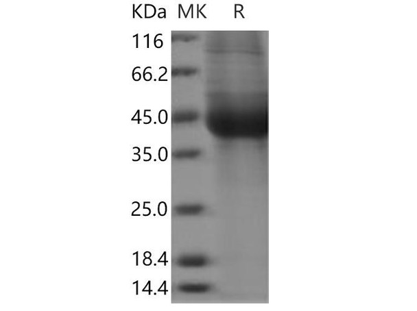 Human IL17BR/IL17RB Recombinant Protein (RPES1249)