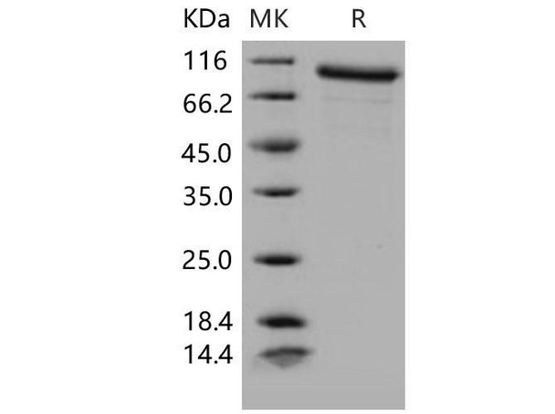 Mouse MMP-9 Recombinant Protein (RPES1253)