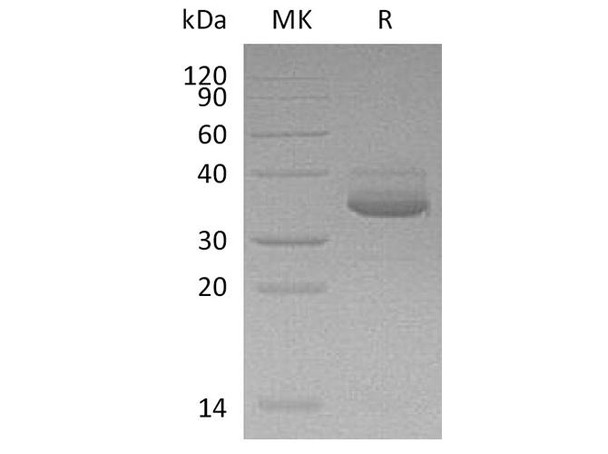 Human CXCL10 Recombinant Protein (RPES1256)