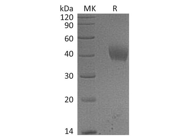 Human IL-20RA/IL-20R1 Recombinant Protein (RPES1257)