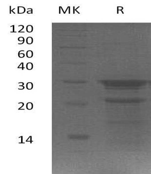 Human PYM1/WIBG Recombinant Protein (RPES1258)