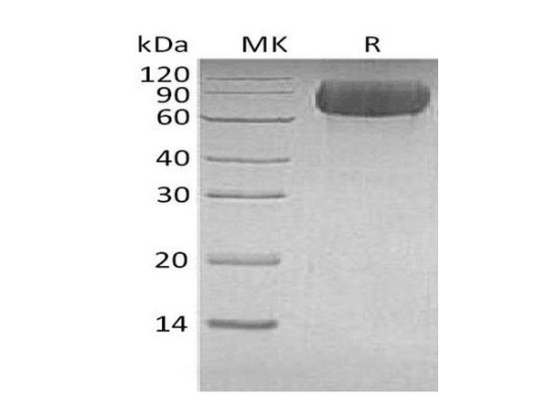 Human LILRB1 Recombinant Protein (RPES1264)