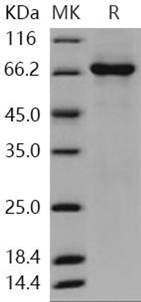 Human TAOK3/JIK/MAP3K18 Recombinant Protein (RPES1267)