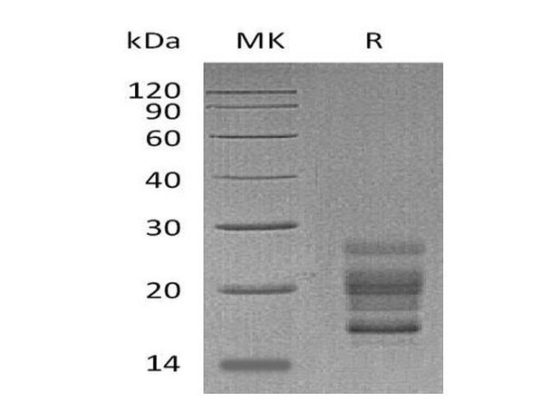 Mouse IL7A Recombinant Protein (RPES1280)