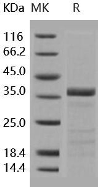 Human tPA/PLAT Recombinant Protein (RPES1289)
