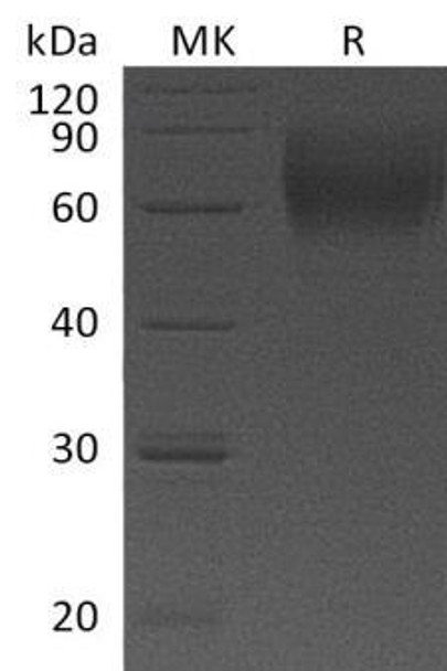 Human IL-23 Recetor/IL-23R Recombinant Protein (RPES1295)