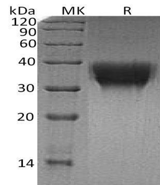 Human TREM1 Recombinant Protein (RPES1297)