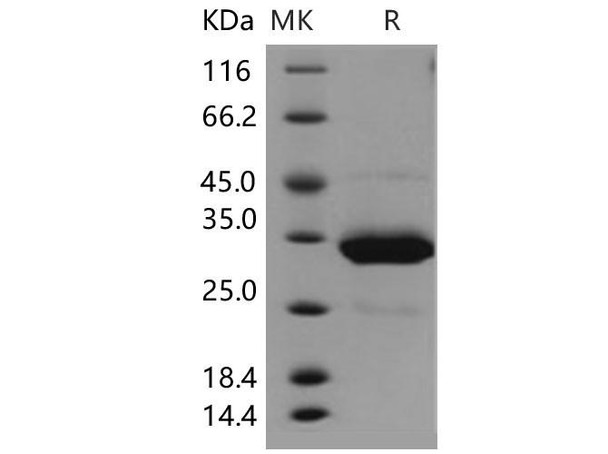 Human IgG1 Fc Recombinant Protein (RPES1306)