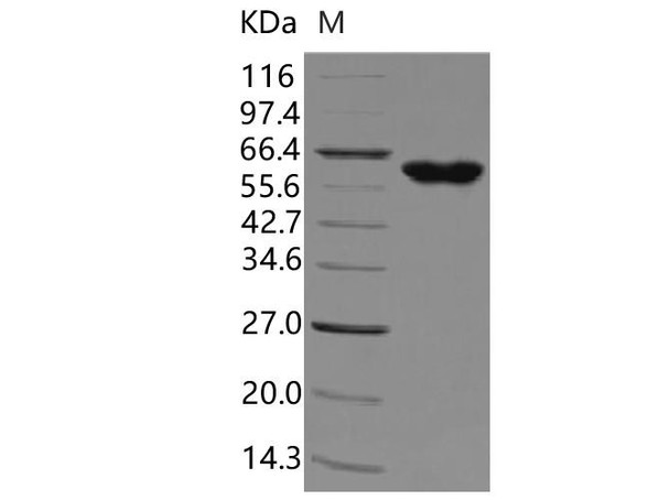 Human tPA/PLAT Recombinant Protein (RPES1307)