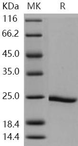 Human HSP90AA1/HSP90 Recombinant Protein (RPES1310)