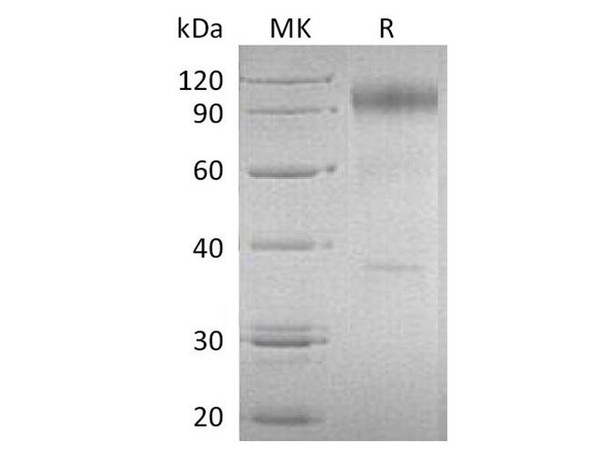 Human IL-23 Recetor/IL-23R Recombinant Protein (RPES1313)